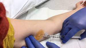 How long does it take to get pregnant after nexplanon removal? Nexplanon Removal Youtube