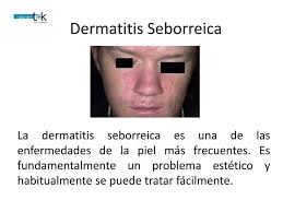 Dermatitis Seborreica