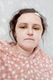 Couple plan wedding in 4 weeks after bride's brain tumor diagnosis