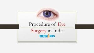 The Two Most Common Eye Surgery Methods Include Photorefractive Keratectomy Prk And Laser Assisted In Situ Keratomileus Eye Surgery Eye Care Health Surgery