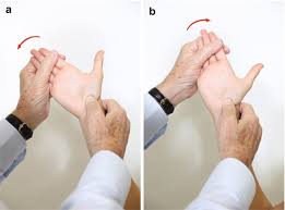 Image result for Scaphoid Shift Test