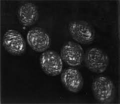 Image result for Polarized Microscopy