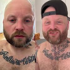 Arron Crascall