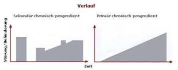 Multiple Sklerose Verlauf Schube Lebenserwartung Netdoktor