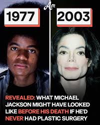 The autopsy exposed where the King of Pop had surgery 😱 — his BEFORE and  AFTER PHOTOS ⬇️