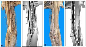 As the two heart tubes fuse to form a single endocardial heart tube, the two primitive aortas fuse to from the aortic sac. Anterior View Of The Arm And Forearm Of The Male Cadaver A Download Scientific Diagram