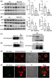NINJ2 deficiency inhibits preadipocyte differentiation and promotes insulin  resistance through regulating insulin signaling - Peng - 2023 - Obesity -  Wiley Online Library