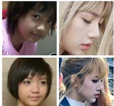 Lisa manoban is the magnae (youngest) of blackpink, she is also their main dancer, lead rapper her nose tip also sat lower before. Did Lisa From Blackpink Get A Nose Job And Eyelid Surgery Quora