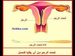 كحت الرحم وتنظيفه وتأثيره على الحمل مع الدكتور عبدالمعطى السمنودى طبيبك اليوم Youtube