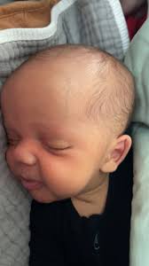 Boo-Boo Salve for Baby Skin Care