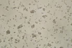 Difference Between Starch Cellulose And Glycogen Structure Properties Source Function