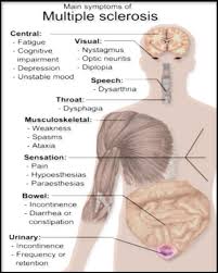 Problems in speech (dysarthria) or swallowing (dysphagia), visual problems. Main Symptoms Of Multiple Sclerosis The Main Clinical Measure In Download Scientific Diagram