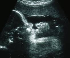 Read more about your baby in week 32. You Are 34 Weeks And 4 Days Pregnant Familyeducation