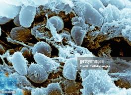 Image result for yersinia fotos