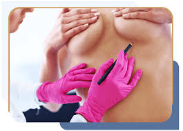Image result for Mastectomy