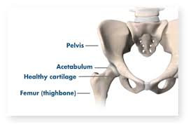 As the cancer develops, though, the pain may become more persistent. Hip Pain Common Causes And Symptoms Stryker