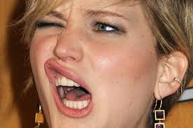 🦷 Les dents de Jennifer Lawrence avant et après