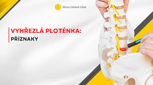 Image result for vyhřezlá ploténka
