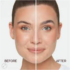 Next up: Allison Epstein, medical student from Case Western Reserve  University @cwru_med @uhcleent presents her work: Housing and Economic  Insecurity Leads to Decreased Rates of Tympanostomy Tube Placement  #ENTSurgery #TRIO2025 #COSM2025