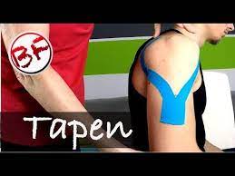 Schulter Tapen Bei Schulterschmerzen Kinesiotape Tutorial Youtube