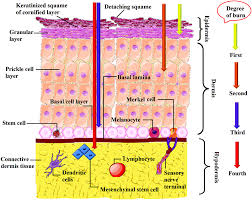 Plant cell walls make up much of the fibre that accumulates in your large intestines. Wound Dressings Functionalized With Silver Nanoparticles Promises And Pitfalls Nanoscale Rsc Publishing