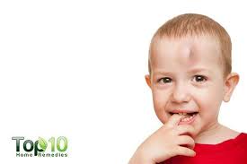 Home Remedies For Swelling On The Head From An Injury Goose Egg Top 10 Home Remedies