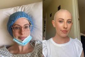 23-latka pomyliła nowotwór z pryszczem: Nigdy nie myślałam, że jestem  zagrożona rakiem, zwłaszcza w moim wieku