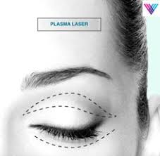 Parawan Teleskopowy Prt 1