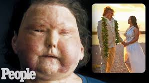 Laughing in the Face of Disability