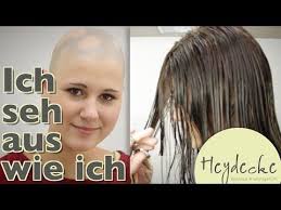 Man unterscheidet nochmal zwischen androgenetischer alopezie (erblichem haarausfall), toxischer alopezie (durch stress oder andere. Kreisrunder Haarausfall Bei Frauen Ich Sehe Aus Wie Ich Dank Heydecke Natureline Echthaar Perucke Youtube Haarausfall Frauen Haarausfall Haare