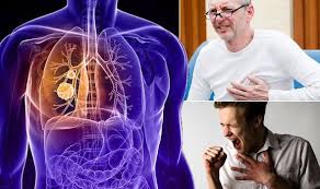 According to roy castle lung cancer foundation (rclcf), a telltale sign your chest infection is cancerous is whether it persists. Lung Cancer Symptoms Early Signs Of Lung Tumour Include Cough Chest Pain Weakness Express Co Uk