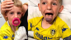 Alemania | Lengua de un niño se atora en una botella | Hannover | Fotos |  La República