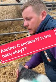 Facing the Challenge of C Sections