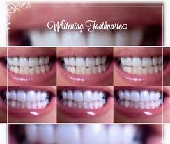 Pin On Whitening Fluoride Toothpaste