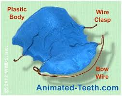 Jun 21, 2020 · one clear retainer cost $85.00 (from sportingsmiles.com) essix retainers through your dentist include a price markup for the dentist's time and costs associated with making your mold. How Much Do Retainers Cost New Replacement Prices Diy Kits