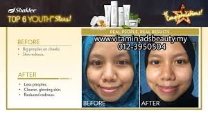 Adakah ianya bermaksud bahawa produk saya telah diluluskan oleh kkm? Produk Kecantikan Yang Selamat Dan Berkesan 2021