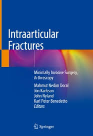 Часть 2 / shingeki no kyojin: Intraarticular Fractures Springerlink