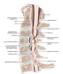 It is an extremely elastic ligament, which connects the spinal bones through its two laminae, articular joints. Ligamentum Flavum Hypertrophy Operative Neurosurgery