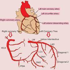 The first diagonal (d1) branch tends to be the most prominent. Right And Left Coronary Trees Lad Left Anterior Descending Artery Download Scientific Diagram