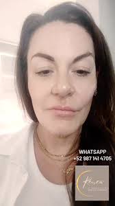 OUR SALON DNA Facial For the first time! Luminous skin... Deeper medical  facial for the win! , #medispacozumel #cozumelbeautyclinic #cozumelbotox  #cozumelfiller