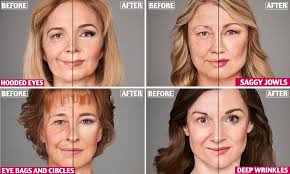 If you are lucky, you may have a genetic disposition that may. Double Chin Best Hairstyles For Sagging Jowls Novocom Top