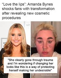 Love the lips”: Amanda Bynes shocks fans with transformation after  revealing new cosmetic procedures (link in the comments)