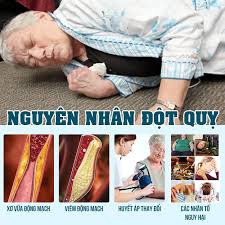 Anh qua đời ở tuổi 49 khi sức khỏe đang hoàn bình thường. Nguyen Nhan Dáº«n Ä'áº¿n Ä'á»™t Quá»µ Dáº¥u Hiá»‡u Nháº­n Biáº¿t NgÆ°á»i Bá»‹ Ä'á»™t Quá»µ Sá»›m