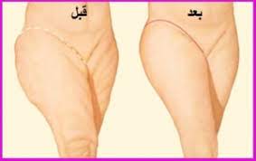 مادة مضافة تؤثر خشب تمارين شد الفخذين من الداخل comertinsaat com