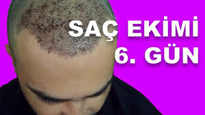 Sac Ekimi 6 Gun Youtube