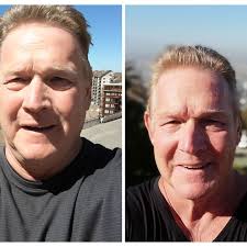 Flying after a stroke, reducing anxiety?