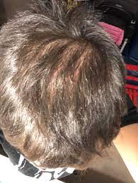We consult a doctor to bust the myth. Am I Losing Hair From Wearing My Headphones All The Time Headphones