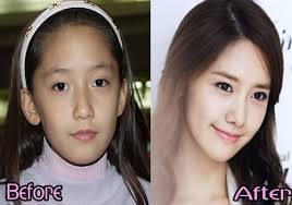 임윤아 / im yoon ah (lim yun a). Pin On Celebrity Before And After