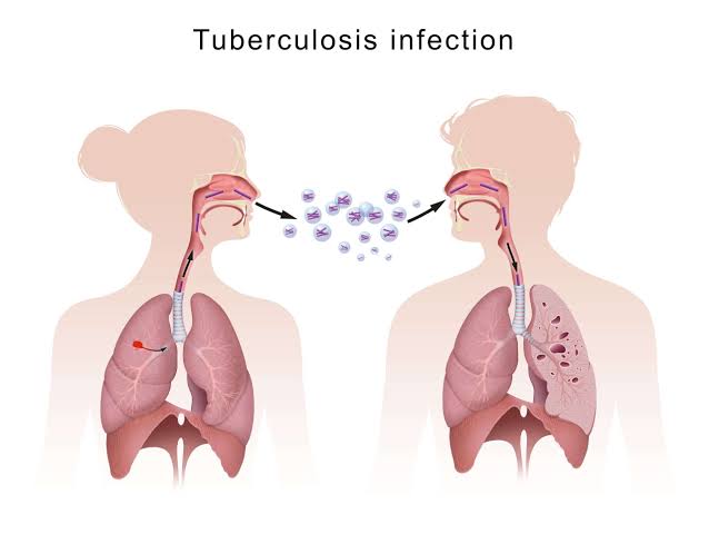 Respiratory Health