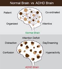 Attention deficit hyperactivity disorder (adhd) is a commonly misunderstood mental health condition. Is Adhd An Obstacle In Your Writing Career The Answer May Surprise You Lifesaver Essays